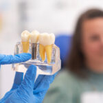 Candidate For Dental Implants - Madison Dentistry & Implant Center - Madison, New Jersey