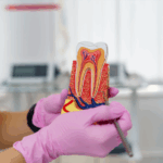 How Long Does Root Canal Numbness Lasts - Madison Dentistry & Implant Center - Madison, New Jersey