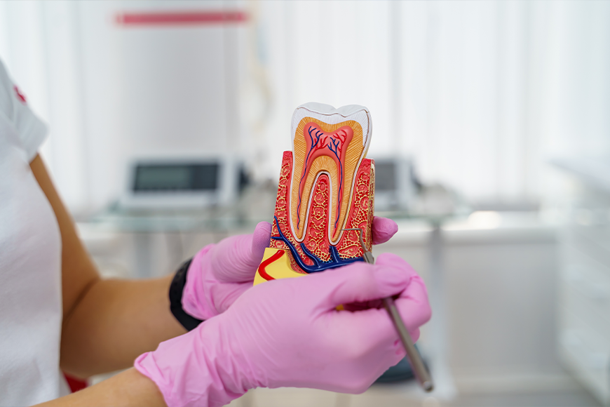 How Long Does Root Canal Numbness Lasts - Madison Dentistry & Implant Center - Madison, New Jersey