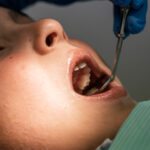 How to Manage Pain Before an Emergency Extraction - Madison Dentistry & Implant Center - Madison, New Jersey