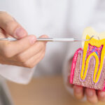 Root Canal VS Filling - Madison Dentistry & Implant Center - Madison, New Jersey