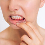 Swollen Gum - Madison Dentistry & Implant Center - Madison, New Jersey