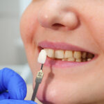Dental Crown Repair - Madison Dentistry & Implant Center - Madison, New Jersey