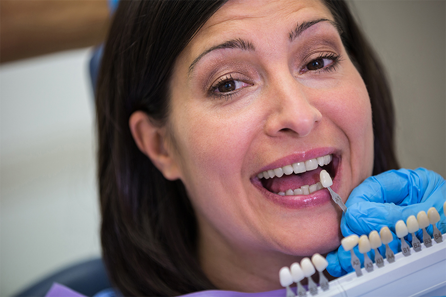 Affordable Dental Implants