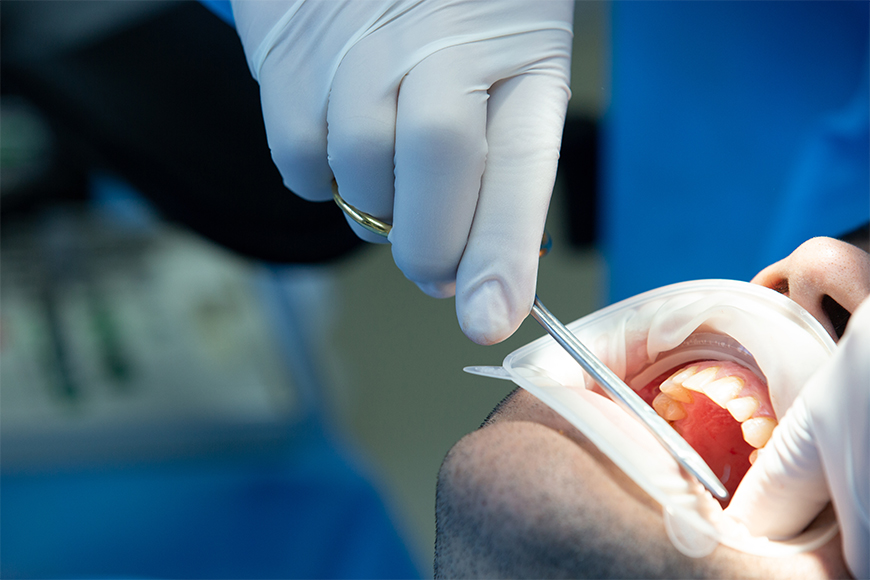 Wisdom Teeth Removal NearMe